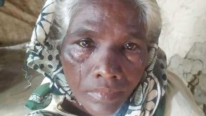 অভাব অনটন আর ভাঙ্গা ঘরে দিন কাটছে কাজল হাঁড়ির