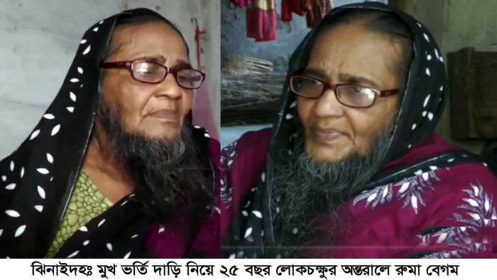 মুখভর্তি দাড়ি নিয়ে ২৫ বছর লোকচক্ষুর অন্তরালে রুমা বেগম!