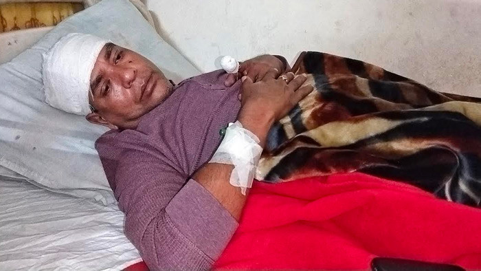 ঝালকাঠিতে ভাগ্নের ছুরির পোচে মামার ছয় সেলাই, হাসপাতালে ভর্তি