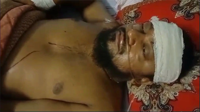 জয়পুরহাটের কালাই উপজেলায় দুর্ধর্ষ ডাকাতি : আহত-৪ গরু ও নগদ টাকা সহ বাড়ির মালামাল লুট