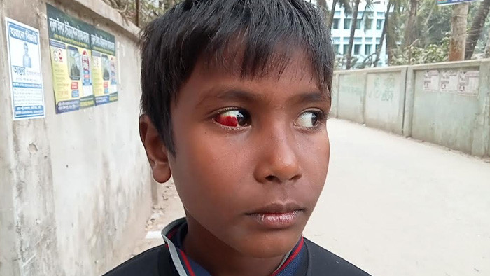 লক্ষ্মীপুরে ওয়ারেন্টের আসামি জামিনে এসে হামলা,আহত-২