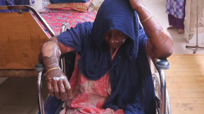 নোয়াখালীতে বিদ্যুতের তার ছিঁড়ে পড়ে বৃদ্ধের মৃত্যু, অগ্নিদগ্ধ-৩