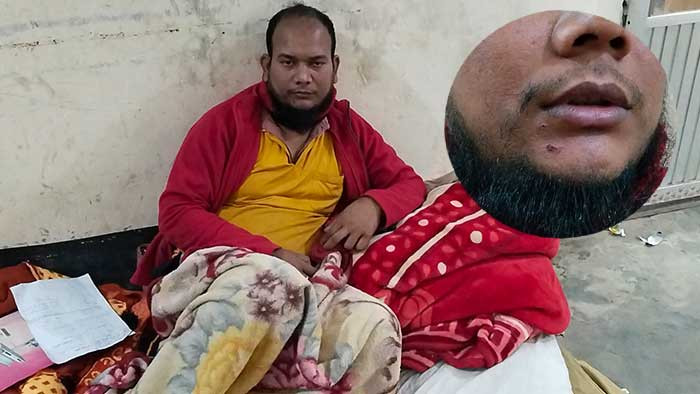 পাওনা টাকা চাওয়ায় ব্যবসায়ীকে মারধর, থানায় অভিযোগের পর রাতের আঁধারে ফের হামলা ও টাকা
