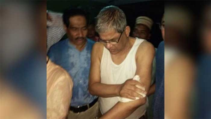 চট্টগ্রামে মির্জা ফখরুলের ওপর হামলা দ্রুত চার্জশিট দাখিলের নির্দেশ